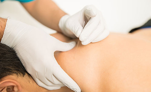 acupuncture-homepage acupuncture greensboro